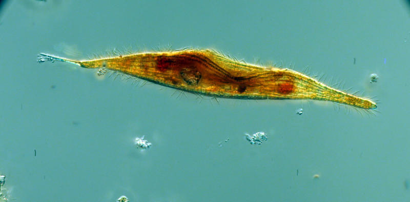 Unicorn ciliate