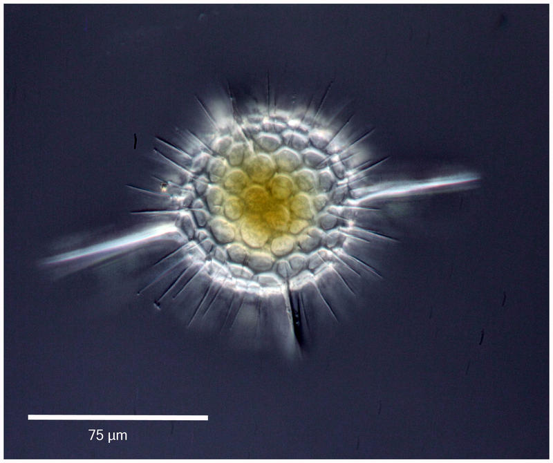 hexacontiumPachy 75umdiam copie