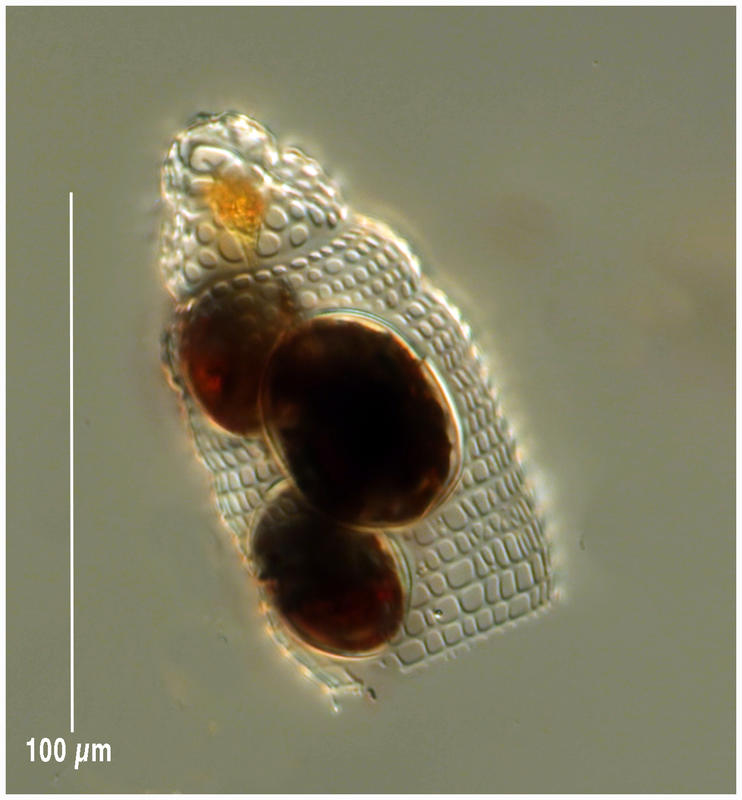 parasitized radiolarian