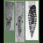 Jean Cachon photos of Xystonella Parasites: Trophont, Spores & Veriform stages (left to right).