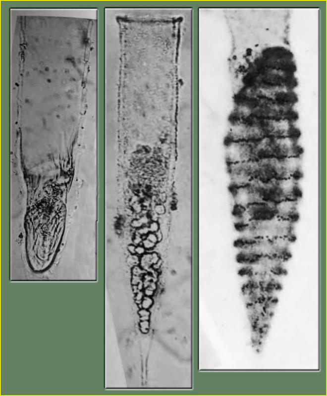 Jean Cachon photos of Xystonella Parasites: Trophont, Spores & Veriform stages (left to right).