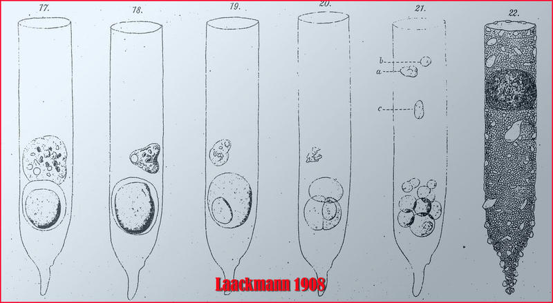 Parasite development in Tintinnopsis radix mistaken for gamete production by Laackmann.