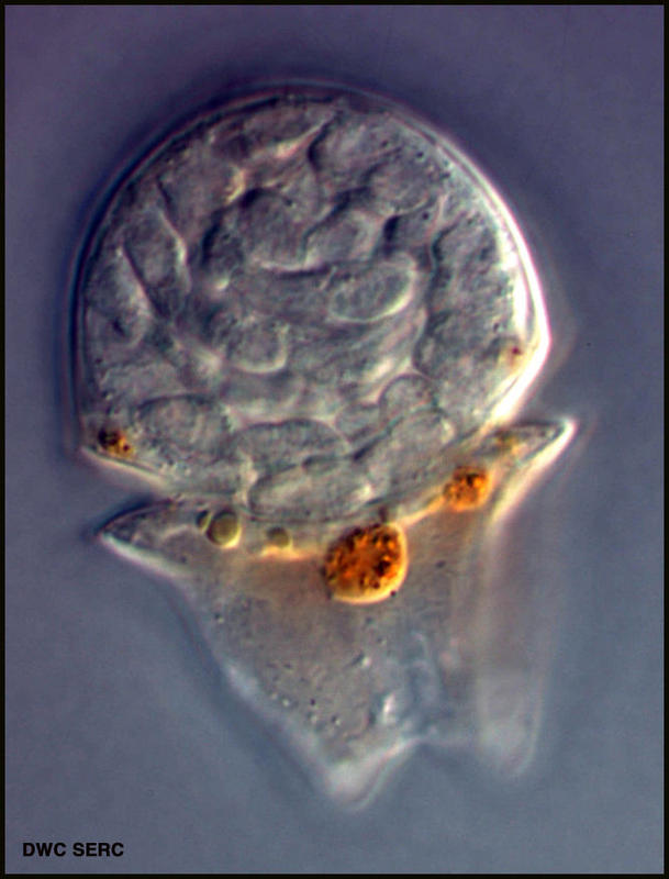 Gymodinid dinoflagellate developing trouble