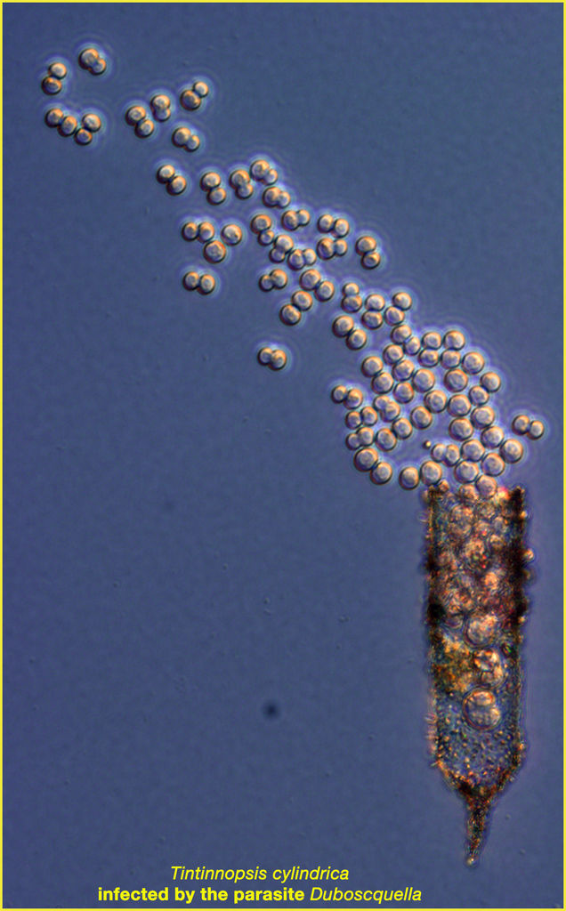 Parasite spores leaving their host, the tintinnid Tintinnopsis cylindrica