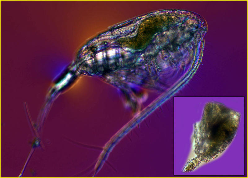 A copepod parasitized.