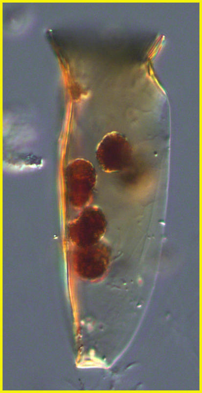 Amphorides quadrilineata parastised probably by a dinophycean.