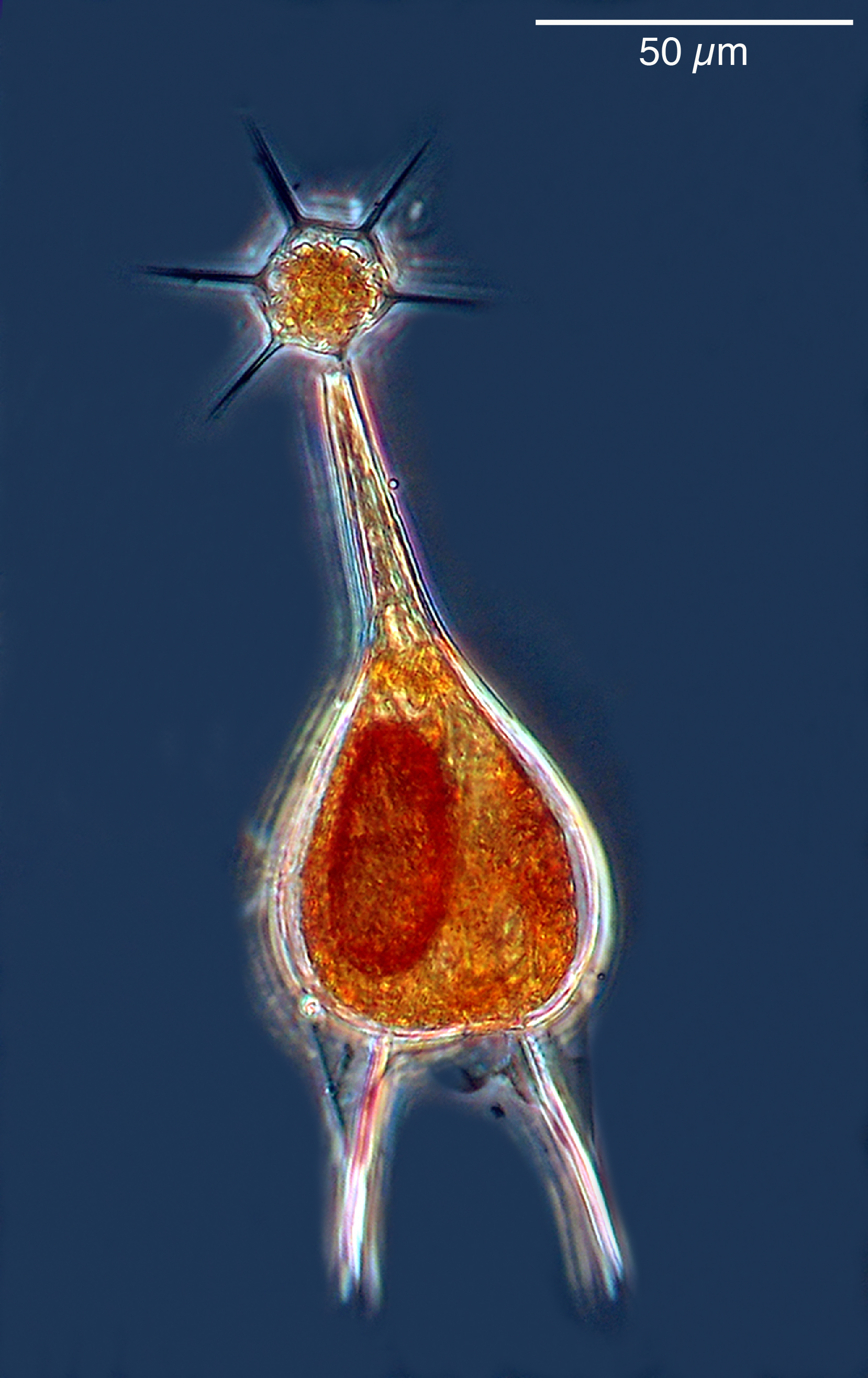 A dinoflagellate (the tripod-shaped cell) sporting a silicoflagellate (star-shaped cell).