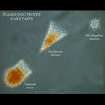 Some plankton protists have hard parts, shells or skeletons.