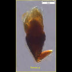 A mixotrophic oligotrich ciliate: Tontonia