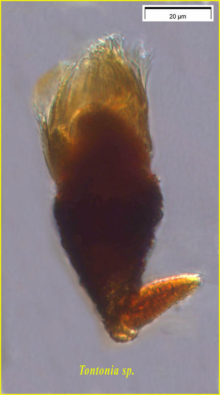 A mixotrophic oligotrich ciliate: Tontonia