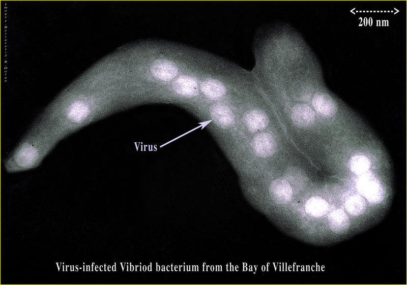 A vibrio-like bacterium (not a protist) infected with viruses.