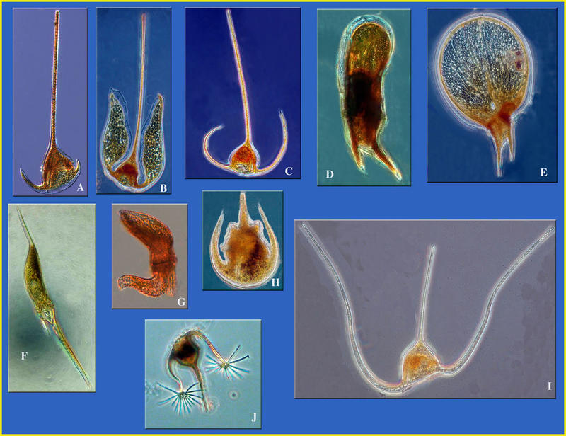 Examples of the diversity of forms in species of the genus Ceratium, dinoflagellates of the phytoplankton (plants).