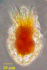 Stenosemella nivalis