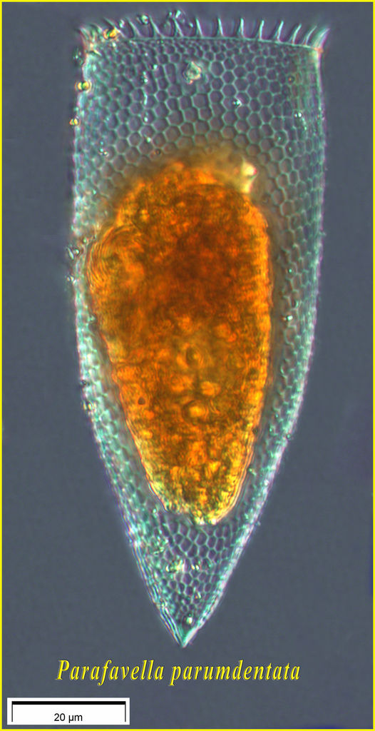 Parafavella  greenlandica (denticulta)