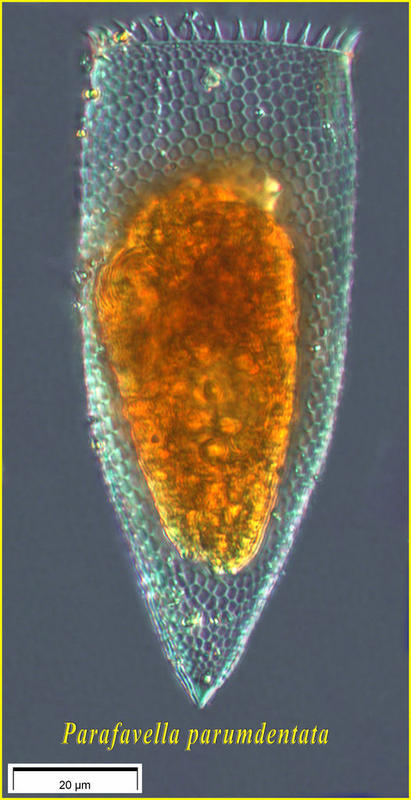 Parafavella  greenlandica (denticulta)