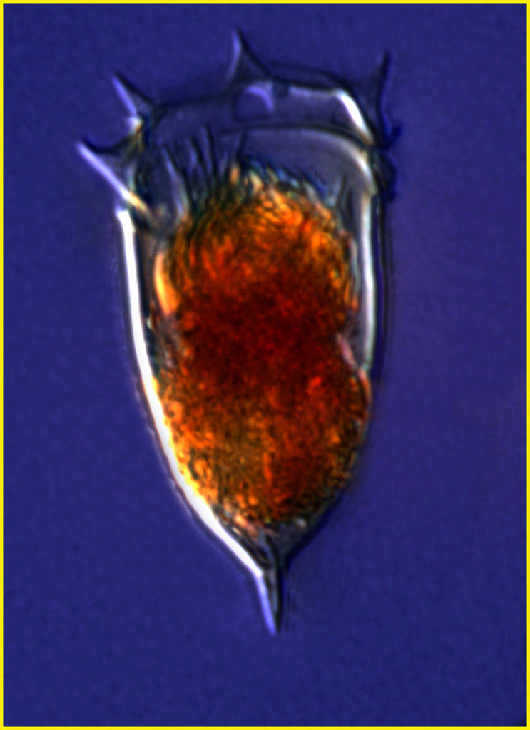Acanthostomella conicoides