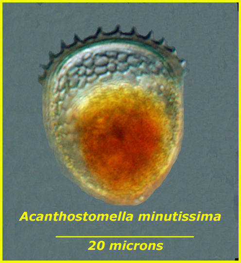 Acanthostomella minutissima