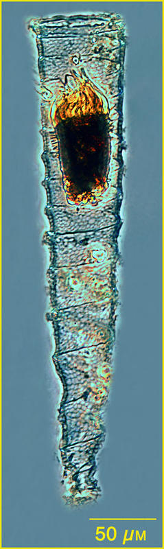 Coxliella fasciata or a variant of Xystonella lohmanni