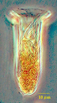 Steenstrupiella gracilus
