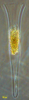 Steenstrupiella intumescens