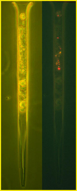 Salpingella acuminata cell contents