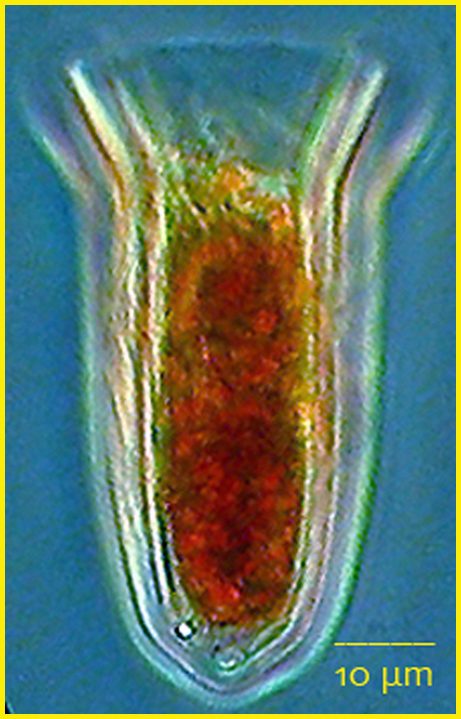 Cantheriella pyrimidata
