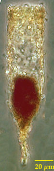 Tintinnopsis radix