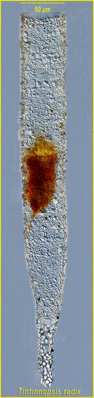 Tintinnopsis radix