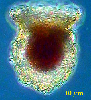Tintinnopsis urnula