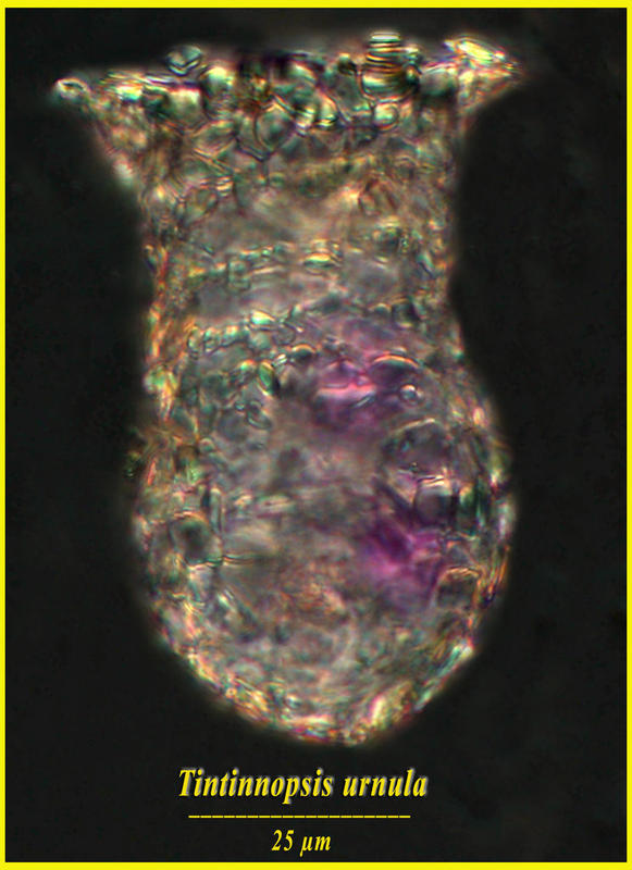 Tintinnopsis urnula