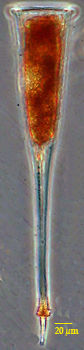 Xystonella treforti