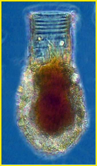 Codonellopsis morchella
