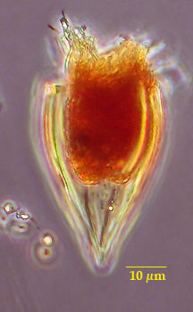 Protorhabdonella simplex
