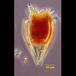 Protorhabdonella simplex