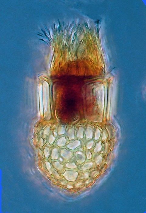 Dictyocysta ampula