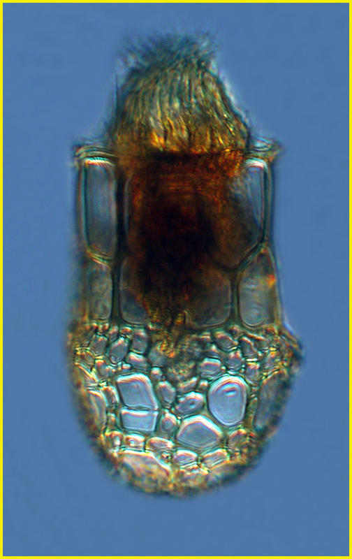 Dictyocysta elegans