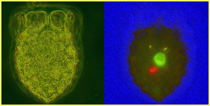 Dictyocysta mitra and ingested food.jpg