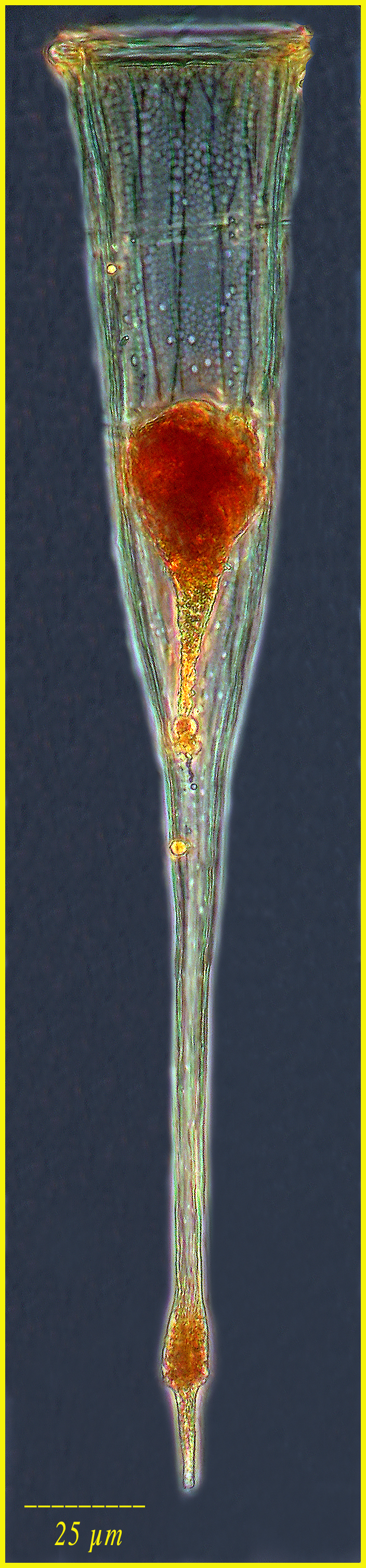 Rhabdonellopsis apophysata