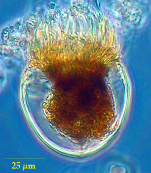 Metacylis mereschkowskii