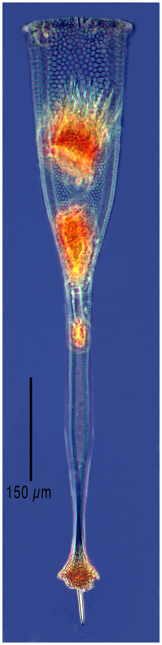 Xystonellopsis clevei