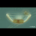 Salad Bowl Diatom