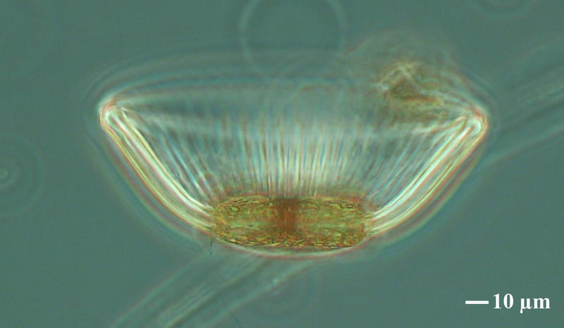 Salad Bowl Diatom