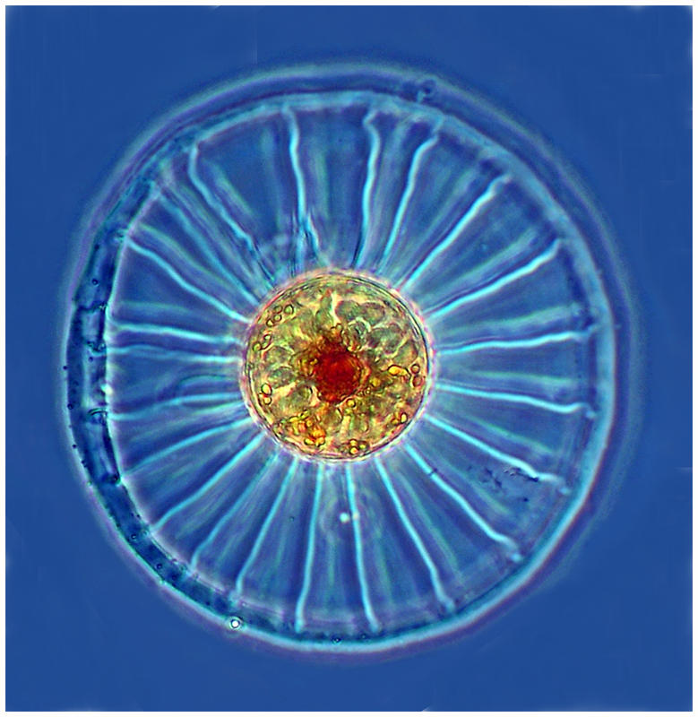 Wagon Wheel Diatom