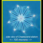 Chaetocerid diatom