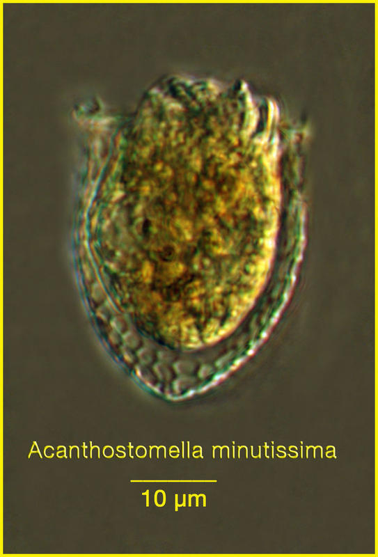 Acanthostomella minutisma