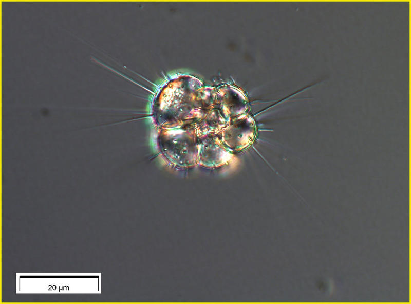 A foraminiferan from 600 m depth in the Aegean Sea.