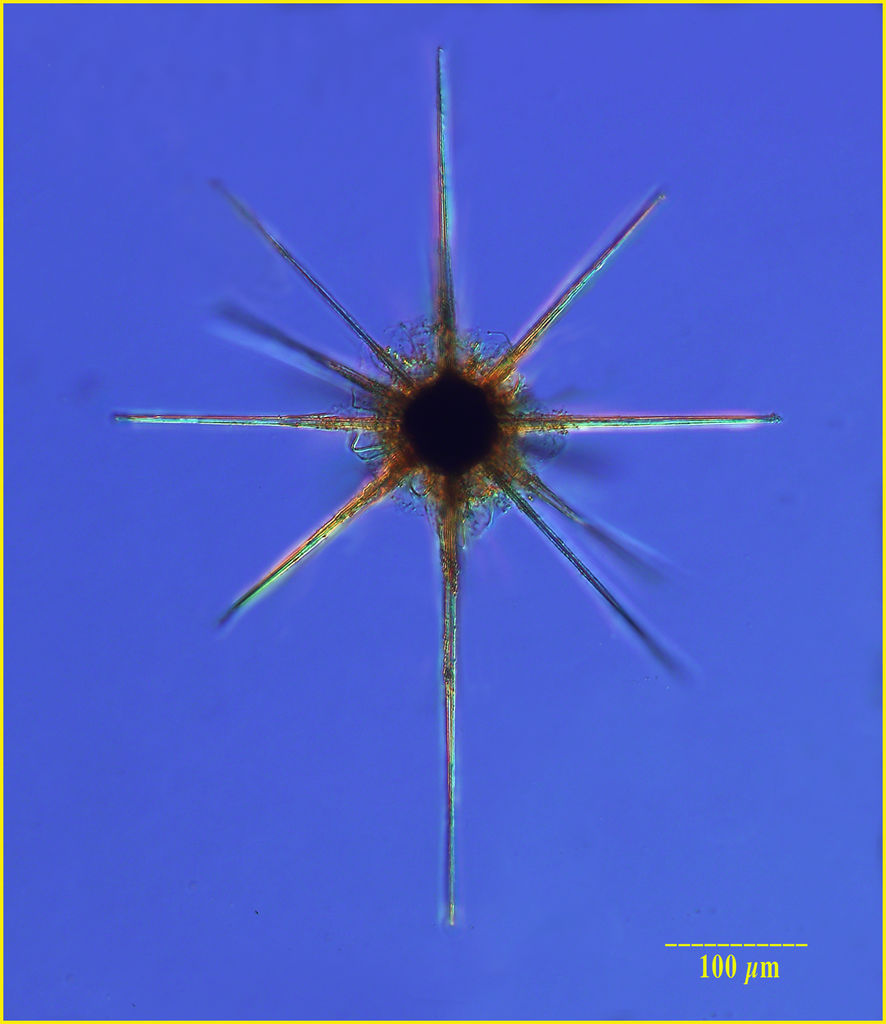 Star Radiolarian (Acantharian subclade F3a of Decelle et al. 2012)