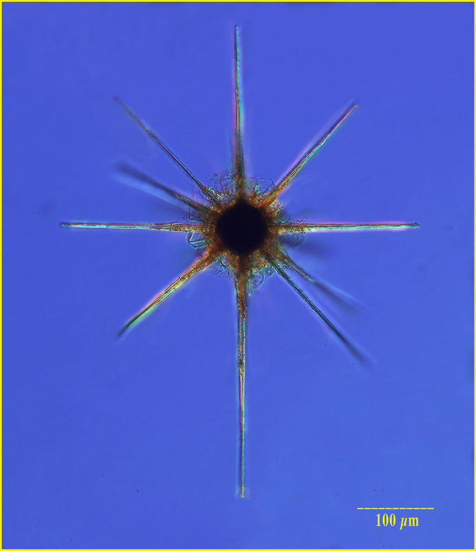 Star Radiolarian (Acantharian subclade F3a of Decelle et al. 2012)