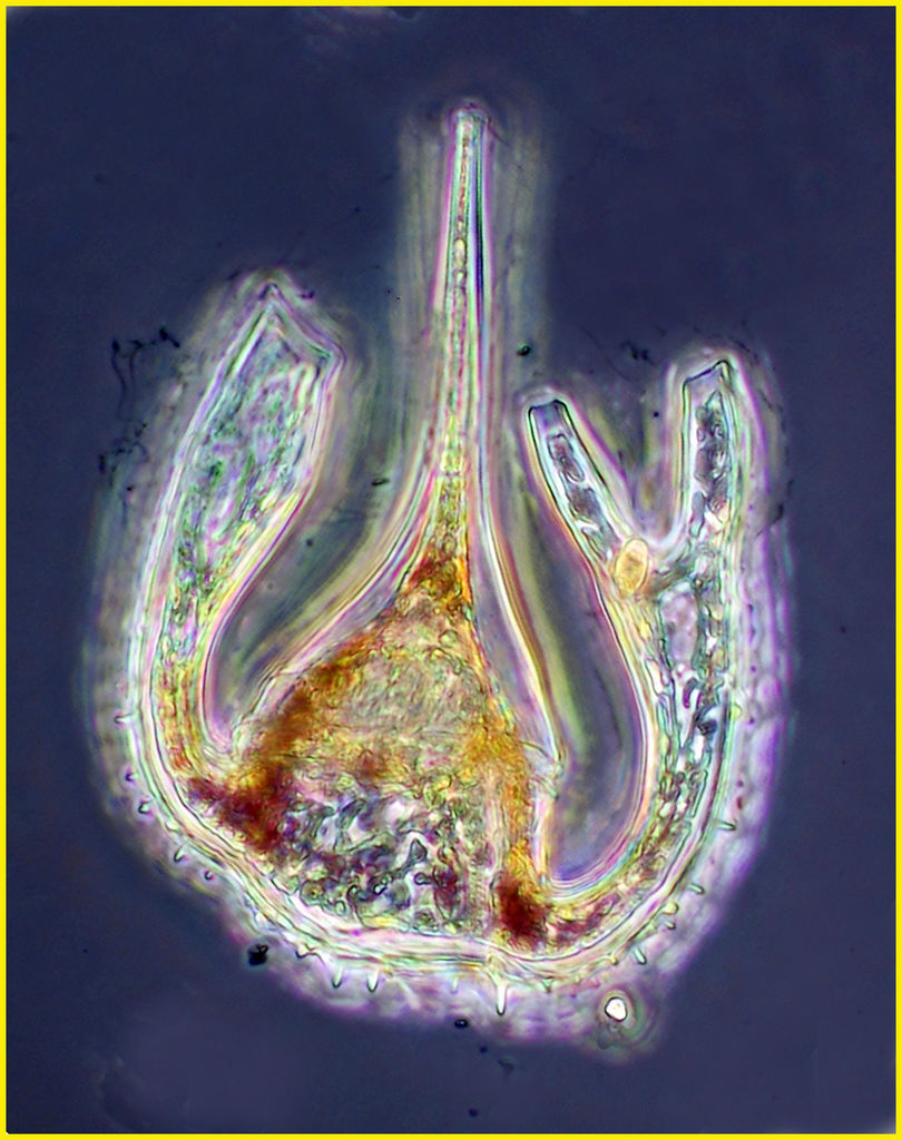 ceratium platycorne - claw!