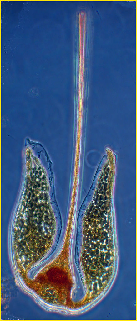 Ceratium platycorne